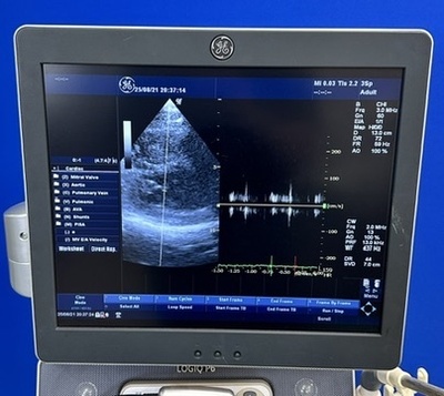 Color Doppler&nbsp;|&nbsp;GE&nbsp;|&nbsp;LOGIQ P6