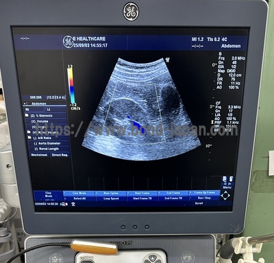 Color Doppler&nbsp;|&nbsp;GE&nbsp;|&nbsp;LOGIQ P6