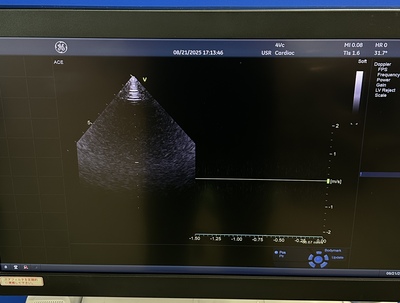 Color Doppler&nbsp;|&nbsp;GE&nbsp;|&nbsp;Vivid E95 Urtla Edition