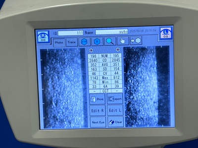 Specular Microscope&nbsp;|&nbsp;TOMEY&nbsp;|&nbsp;EM-3000