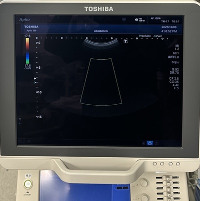 Color Doppler&nbsp;|&nbsp;CANON&nbsp;|&nbsp;Aplio 300