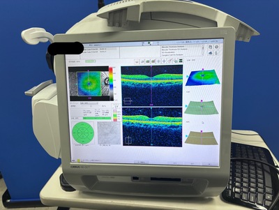 Zeiss OCT&nbsp;|&nbsp;Carl Zeiss&nbsp;|&nbsp;Cirrus 500 HD-OCT Plus