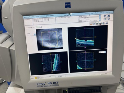 OCT&nbsp;|&nbsp;Carl Zeiss&nbsp;|&nbsp;Cirrus 4000 HD OCT