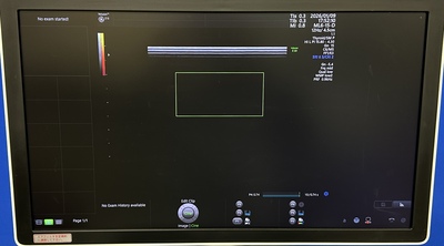 4D Ultrasound&nbsp;|&nbsp;GE&nbsp;|&nbsp;Voluson E10 BT18