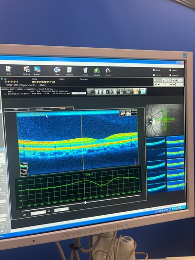 Retinal Camera and OCT Combined&nbsp;|&nbsp;NIDEK&nbsp;|&nbsp;RS-3000