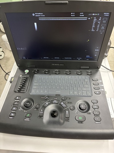 Portable Color doppler&nbsp;|&nbsp;GE&nbsp;|&nbsp;Versana Active