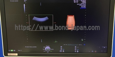 4D Ultrasound&nbsp;|&nbsp;GE&nbsp;|&nbsp;Voluson E10 BT18