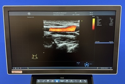 Ultrasound&nbsp;|&nbsp;GE&nbsp;|&nbsp;Vivid S60N