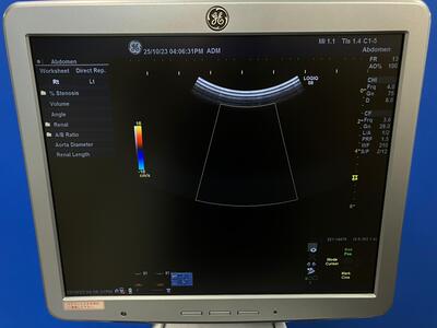Color Doppler&nbsp;|&nbsp;GE&nbsp;|&nbsp;LOGIQ S8
