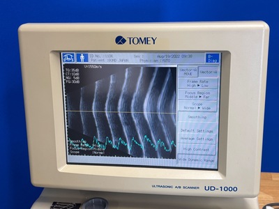 B Scanner Ultrasound Unit&nbsp;|&nbsp;TOMEY&nbsp;|&nbsp;UD-1000