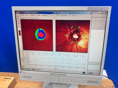 Retina Topo&nbsp;|&nbsp;Heidelberg Engineering GmbH&nbsp;|&nbsp;Retina Tomograph 2 HRT II