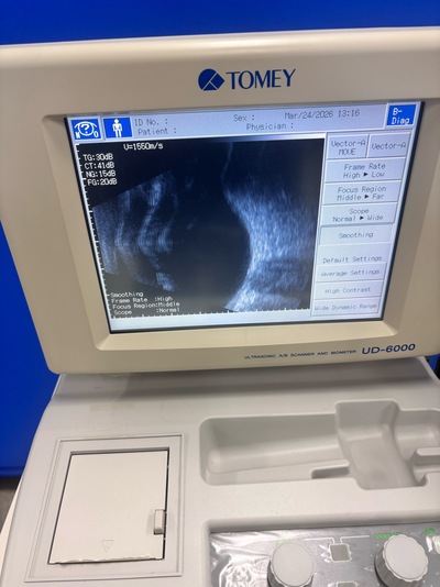 A, B, UBM Scanner&nbsp;|&nbsp;TOMEY&nbsp;|&nbsp;UD-6000