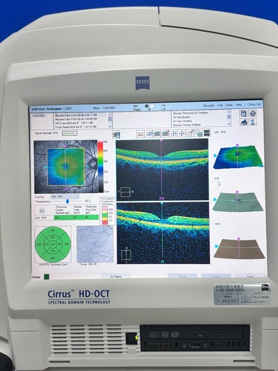 High-demended OCT&nbsp;|&nbsp;Carl Zeiss&nbsp;|&nbsp;Cirrus 4000 HD OCT