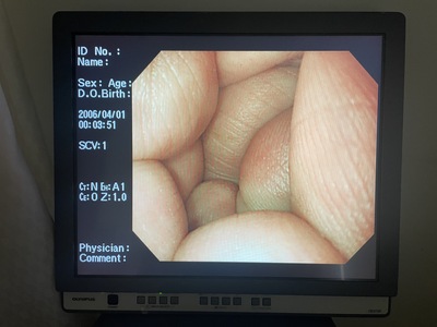 Endoscopy System&nbsp;|&nbsp;OLYMPUS&nbsp;|&nbsp;LUCERA CV-260SL