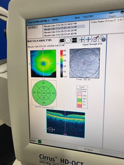 Windows 10 PRO Zeiss OCT&nbsp;|&nbsp;Carl Zeiss&nbsp;|&nbsp;Cirrus 4000 HD OCT