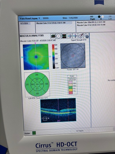 Windows 10 Pro Zeiss OCT&nbsp;|&nbsp;Carl Zeiss&nbsp;|&nbsp;Cirrus 4000 HD OCT