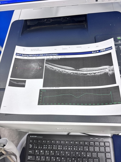 OCT with Fundus function&nbsp;|&nbsp;NIDEK&nbsp;|&nbsp;RS-3000