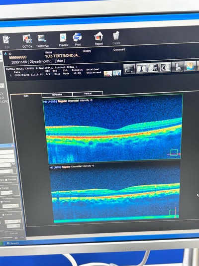 Advanced OCT&nbsp;|&nbsp;NIDEK&nbsp;|&nbsp;RS-3000 Advance