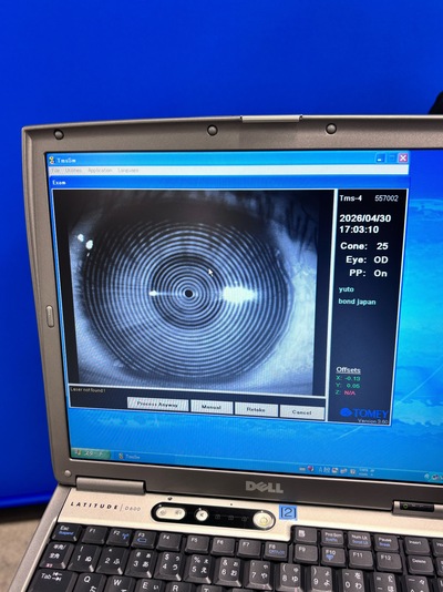 Corneal Topographer System&nbsp;|&nbsp;TOMEY&nbsp;|&nbsp;TMS-4