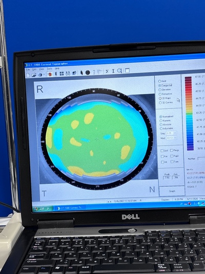 Corneal Topographer System&nbsp;|&nbsp;SHIN-NIPPON&nbsp;|&nbsp;CT-1000