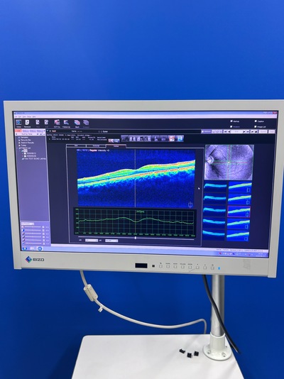 Advanced OCT + Fundus camera&nbsp;|&nbsp;NIDEK&nbsp;|&nbsp;RS-330 Retina Scan Duo
