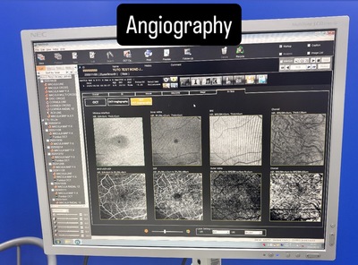 Fully Refurbished OCT with Angiography + Anterior Lens kit&nbsp;|&nbsp;NIDEK&nbsp;|&nbsp;RS-3000 Advance