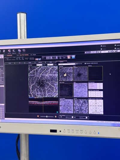 ANGIOGRAPHY Installed. No injections required. An unprecedented, high-definition 3D map of retinal blood flow drawn with light.&nbsp;|&nbsp;NIDEK&nbsp;|&nbsp;RS-3000 Advance