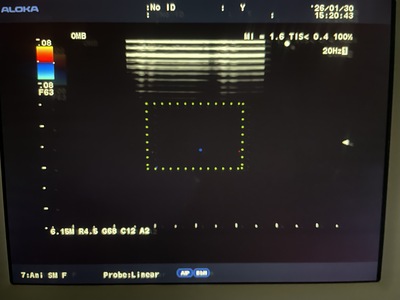 Ultrasound System&nbsp;|&nbsp;HITACHI&nbsp;|&nbsp;Prosound α7