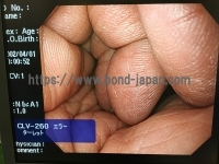 Video Gastroscope&nbsp;|&nbsp;OLYMPUS&nbsp;|&nbsp;GIF-H260