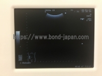 超音波診断装置&nbsp;|&nbsp;日立アロカメディカル株式会社&nbsp;|&nbsp;Prosound 2の写真