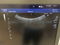 超音波診断装置/カラードプラ&nbsp;|&nbsp;キャノンメディカル株式会社&nbsp;|&nbsp;TUS-X100 Xario 100の写真