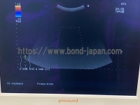 Color Doppler&nbsp;|&nbsp;ALOKA&nbsp;|&nbsp;Prosound Alpha 10