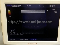 Color Doppler&nbsp;|&nbsp;HITACHI&nbsp;|&nbsp;Prosound α6