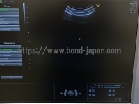 4D Ultrasound&nbsp;|&nbsp;GE&nbsp;|&nbsp;Voluson E8 Expert