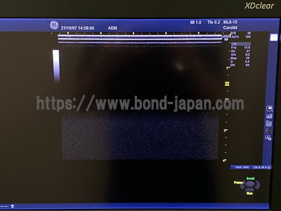 超音波診断装置/カラードプラ &nbsp;|&nbsp;GEヘルスケア・ジャパン株式会社&nbsp;|&nbsp;Logiq S8 XDclearの写真