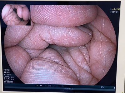 Video Gastroscope&nbsp;|&nbsp;FUJIFILM&nbsp;|&nbsp;EG-580NW2