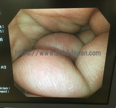 Video Gastroscope&nbsp;|&nbsp;OLYMPUS&nbsp;|&nbsp;GIF-XQ240