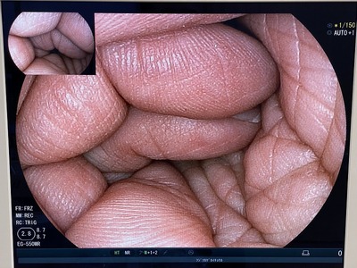 Video Gastroscope&nbsp;|&nbsp;FUJIFILM&nbsp;|&nbsp;EG-550WR