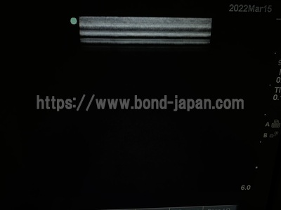 Color Doppler&nbsp;|&nbsp;SonoSite&nbsp;|&nbsp;M-Turbo