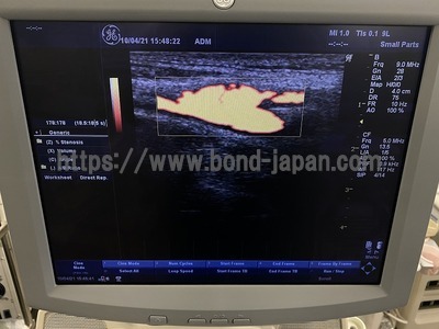 Color Doppler&nbsp;|&nbsp;GE&nbsp;|&nbsp;LOGIQ P5