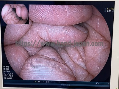 上部消化管経鼻用ビデオスコープ&nbsp;|&nbsp;富士フイルムメディカル株式会社&nbsp;|&nbsp;EG-580NW2の写真