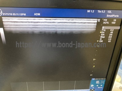 超音波診断装置/カラードプラ&nbsp;|&nbsp;GEヘルスケア・ジャパン株式会社&nbsp;|&nbsp;LOGIQ e Premiumの写真