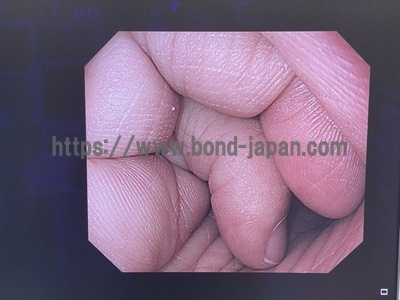 Video Gastroscope&nbsp;|&nbsp;OLYMPUS&nbsp;|&nbsp;GIF-H290