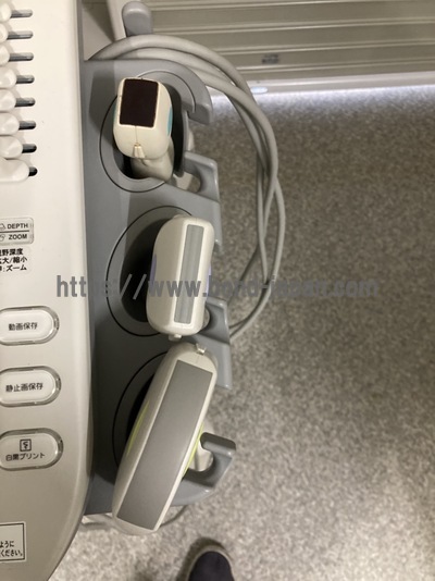 超音波診断装置/カラードプラ&nbsp;|&nbsp;キャノンメディカル株式会社&nbsp;|&nbsp;TUS-X100 Xario 100の写真