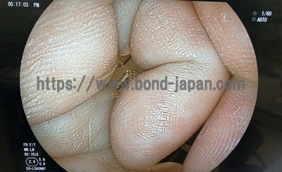 Video Gastroscope&nbsp;|&nbsp;Fujifilm&nbsp;|&nbsp;EG-L580NW7