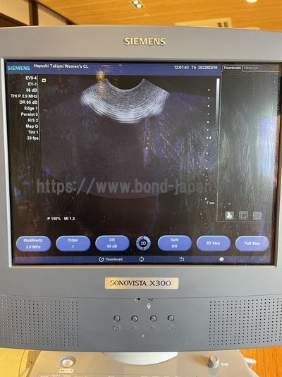 Color Doppler&nbsp;|&nbsp;SIEMENS&nbsp;|&nbsp;X300