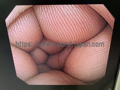 上部消化管スコープ&nbsp;|&nbsp;オリンパス&nbsp;|&nbsp;GIF-H290Zの写真