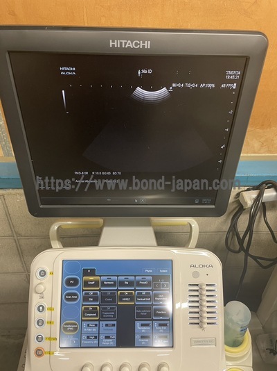 超音波診断装置&nbsp;|&nbsp;日立製作所&nbsp;|&nbsp;ARIETTA 60の写真