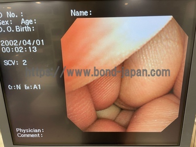 Laparoscope&nbsp;|&nbsp;OLYMPUS&nbsp;|&nbsp;LTF-240