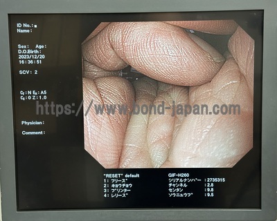 Video Gastroscope&nbsp;|&nbsp;OLYMPUS&nbsp;|&nbsp;GIF-H260